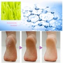 فرشة تنظيف وتقشير القدم وإزالة الجلد الميت بسهولة في المنزل كالمحترفين