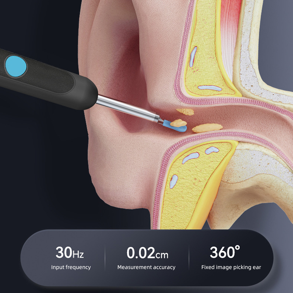 جهاز إزالة الشمع و الأوساخ من الأذن الذكي و المتطور المزود بكاميرا