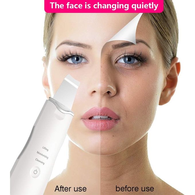 جهاز الترا سونيك