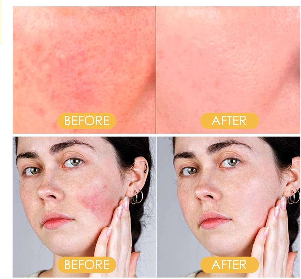 ستيكر صن بلوك لقياس مقياس الاشعه البنفسجيه