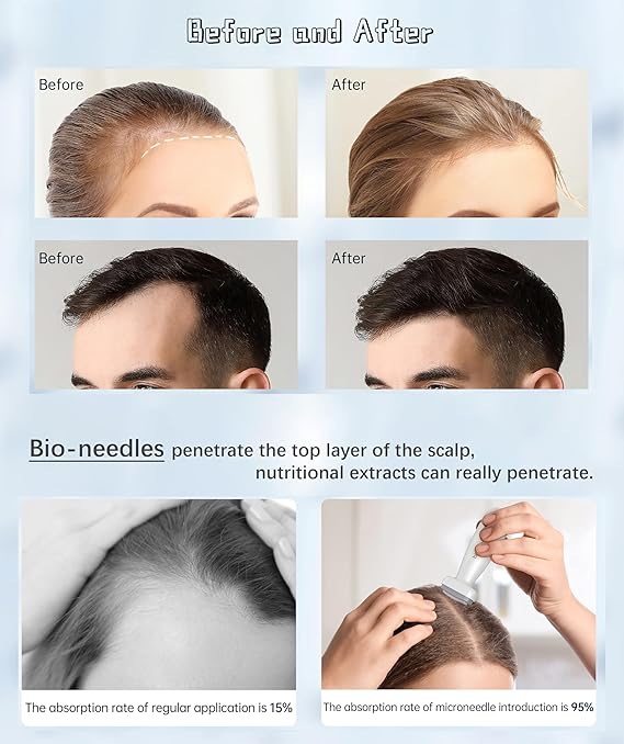 قلم ديرما ستامب 120 إبرة قابل للتعديل 0-2 ملم للعناية بالبشرة والشعر