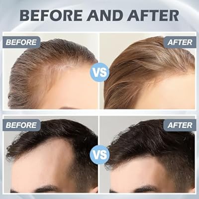 قلم ديرما ستامب 120 إبرة قابل للتعديل 0-2 ملم للعناية بالبشرة والشعر