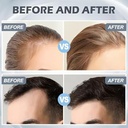 قلم ديرما ستامب 120 إبرة قابل للتعديل 0-2 ملم للعناية بالبشرة والشعر