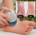 حجر كهربائي لإزالة الجلد الميت من القدمين بسرعة 2000 دورة في الدقيقة